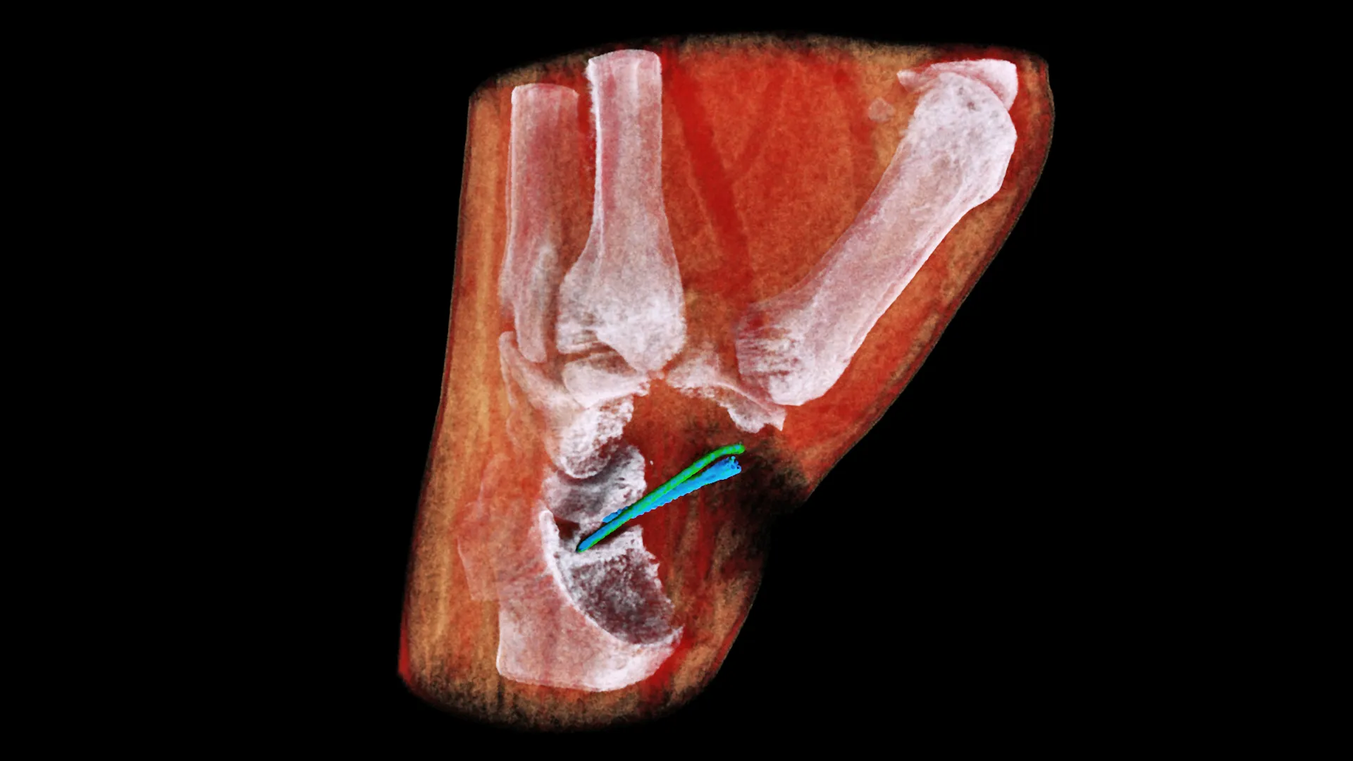 New 3D colour X-rays made possible with CERN technology