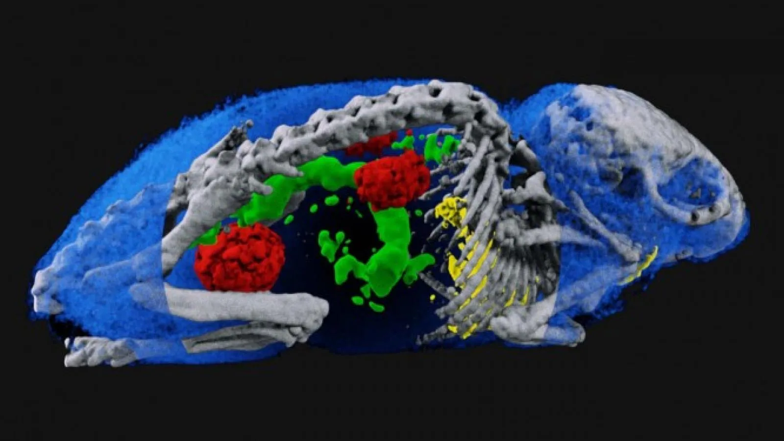 Spectral imaging: from CERN to medical technologies